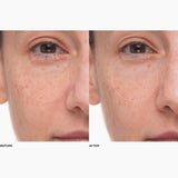 Plumtox | Clarifying Enzyme Mask