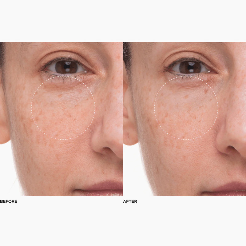 Plumtox | Clarifying Enzyme Mask