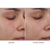 Pore Refining Complex Serum